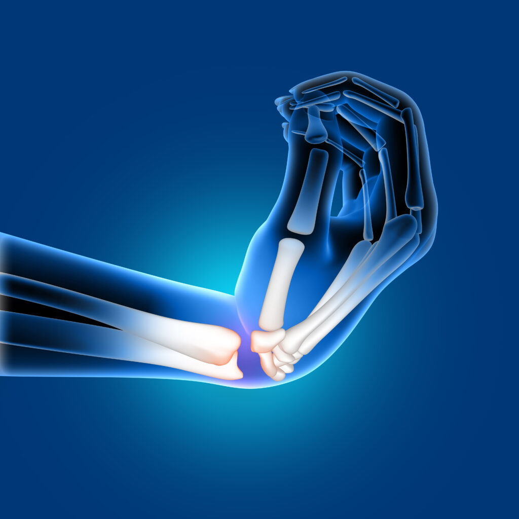 Best Hand Surgery Hospital and Surgeon in Jaipur