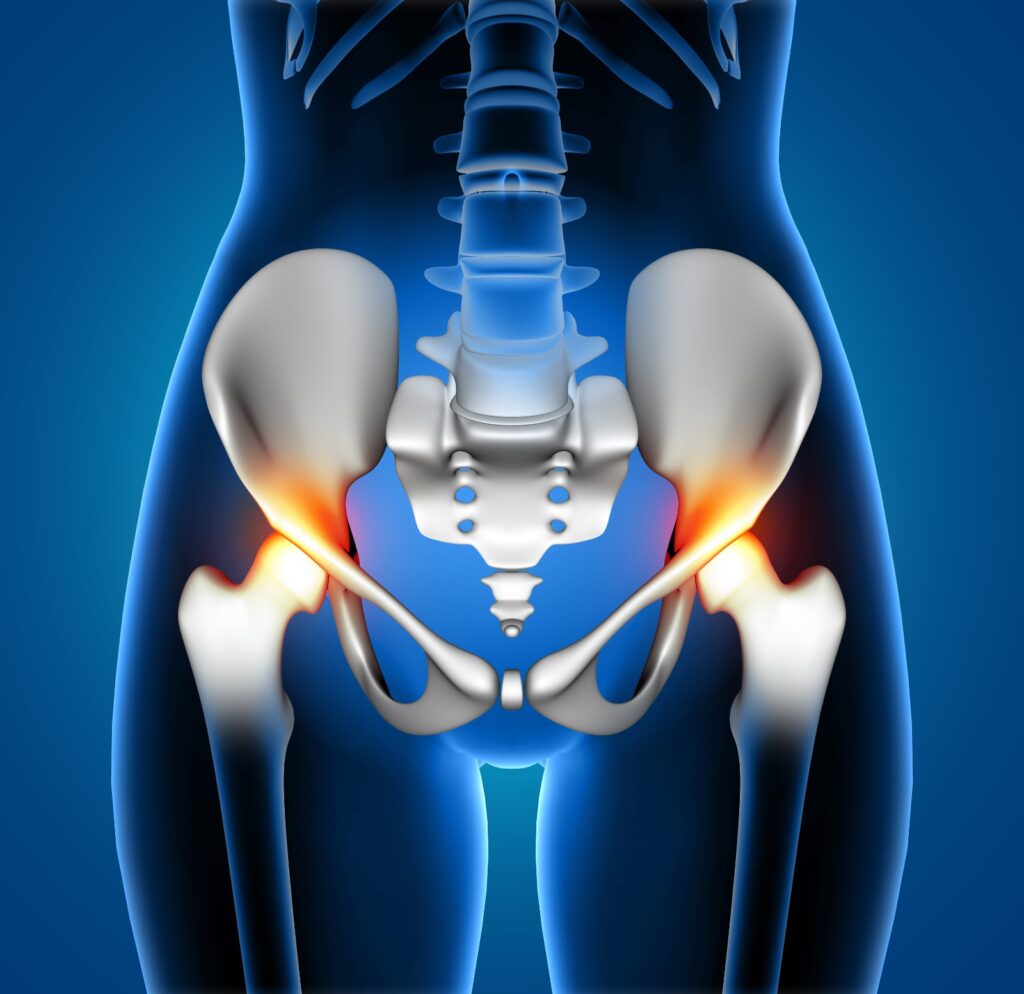 Best Hip Replacement Hospital in Jaipur